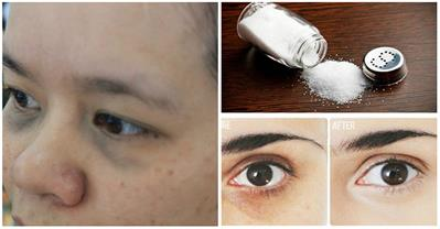 Chỉ với 1 thìa muối, quầng thâm sẽ biến mất sau 5 phút