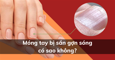 qq8876g tay bị sần gợn sóng là THIẾU CHẤT gì, phản ánh gì về sức khỏe?
